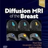 DIFFUSION MRI OF THE BREAST, E-Book