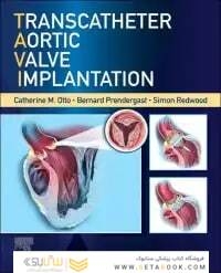 Transcatheter Aortic Valve Implantation