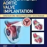 Transcatheter Aortic Valve Implantation