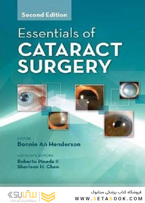 Essentials of Cataract Surgery 2nd Edition2014 موارد ضروری جراحی آب مروارید
