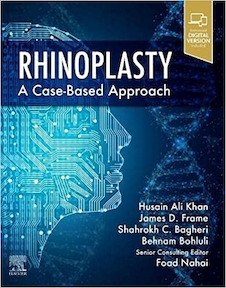 عکس Rhinoplasty: a Case-based approach