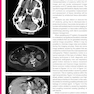 CT Anatomy for Radiotherapy2017