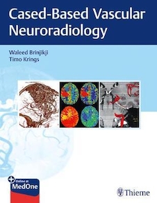 عکس Imaging in Neurovascular Disease A Case-Based Approach