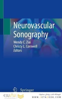 Neurovascular Sonography