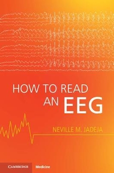 عکس How to Read an EEG