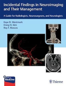 عکس Incidental Findings in Neuroimaging and Their Management: A Guide for Radiologists, Neurosurgeons, and Neurologists