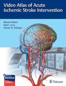 عکس Video Atlas of Acute Ischemic Stroke Intervention