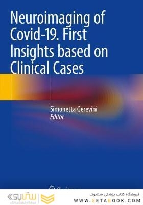Neuroimaging of Covid-19. First Insights based on Clinical Cases
