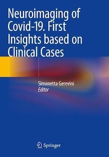 عکس Neuroimaging of Covid-19. First Insights based on Clinical Cases