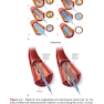 The Interventional Cardiac Catheterization Handbook