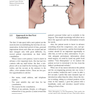 Basic Open Rhinoplasty : Principles and Practical Steps for Surgeons in Training