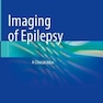 Imaging of Epilepsy: A Clinical Atlas