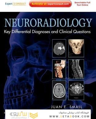 Neuroradiology: Key Differential Diagnoses and Clinical Question
