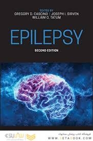 Adult Epilepsy