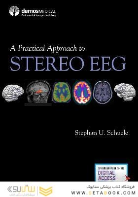 A Practical Approach to Stereo EEG
