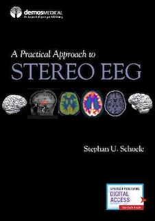 عکس A Practical Approach to Stereo EEG