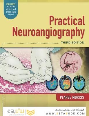 Practical Neuroangiography