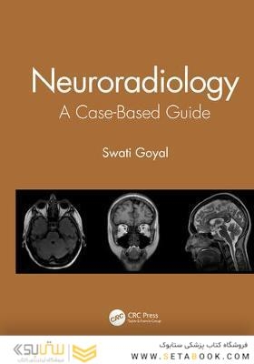 Neuroradiology : A Case-Based Guide