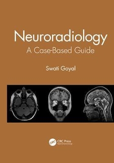 عکس Neuroradiology : A Case-Based Guide