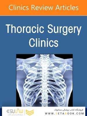 Esophageal Cancer,An Issue of Thoracic Surgery Clinics