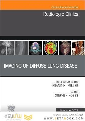 Imaging of Diffuse Lung Disease, An Issue of Radiologic Clinics of North America