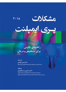 عکس مشکلات پری - ایمپلنت