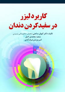 عکس کاربرد لیزر در سفید کردن دندان