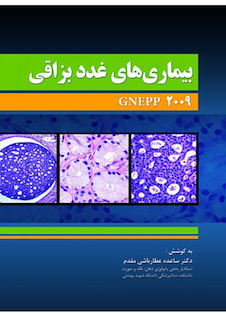عکس بیماری های غدد بزاقی Gnepp 2009