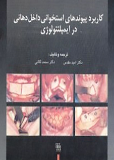 عکس کاربرد پیوندهای استخوانی داخل دهانی در ایمپلنتولوژی