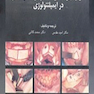 کاربرد پیوندهای استخوانی داخل دهانی در ایمپلنتولوژی