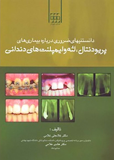 عکس دانستنیهای ضروری درباره بیماری های پریودنتال لثه و ایمپلنت های دندانی
