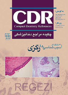 عکس CDR چکیده مراجع دندانپزشکی مروری بر آسیب شناسی دهان رگزی