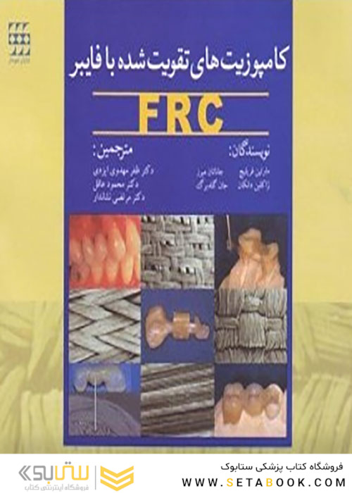 کامپوزیت های تقویت شده با فایبر FRC