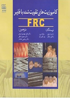 عکس کامپوزیت های تقویت شده با فایبر FRC