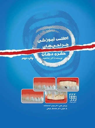 عکس اطلس آموزشی جراحی های حفره دهان