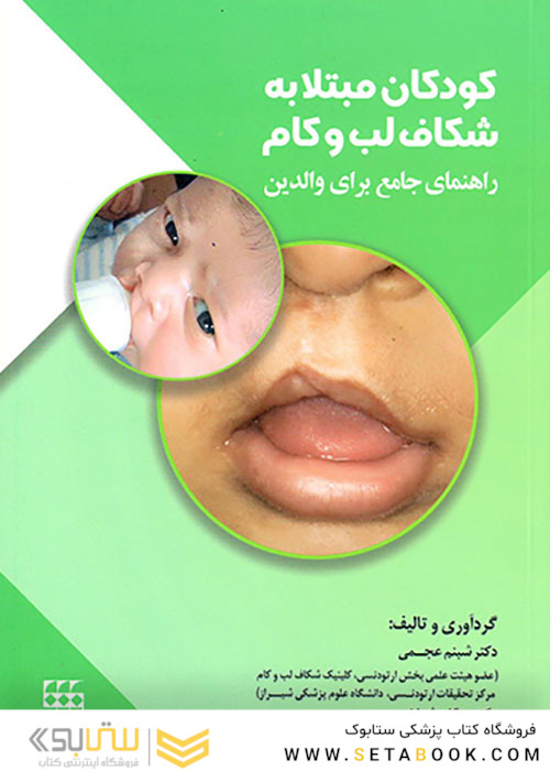 کودکان مبتلا به شکاف لب و کام
