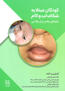 عکس کودکان مبتلا به شکاف لب و کام