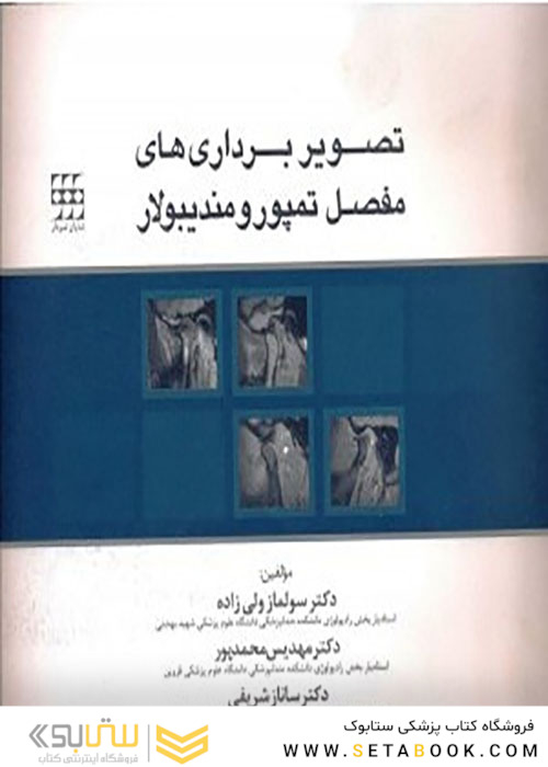 تصویربرداری های مفصل تمپورومندیبولار