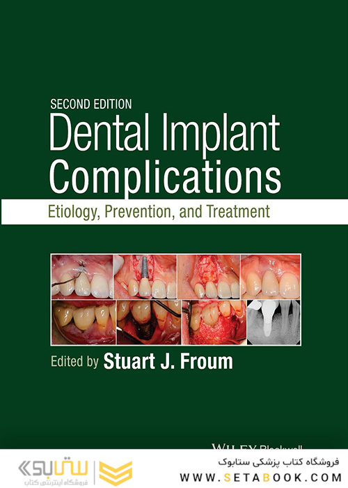 Dental Implant Complications: Etiology, Prevention, and Treatment 2nd Edition