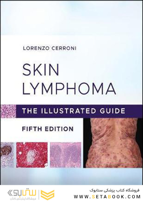 Skin Lymphoma The Illustrated Guide 5th Edition 2020