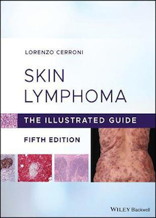 عکس Skin Lymphoma The Illustrated Guide 5th Edition 2020