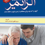 آلزایمر