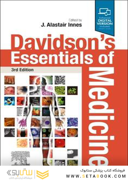 Davidson