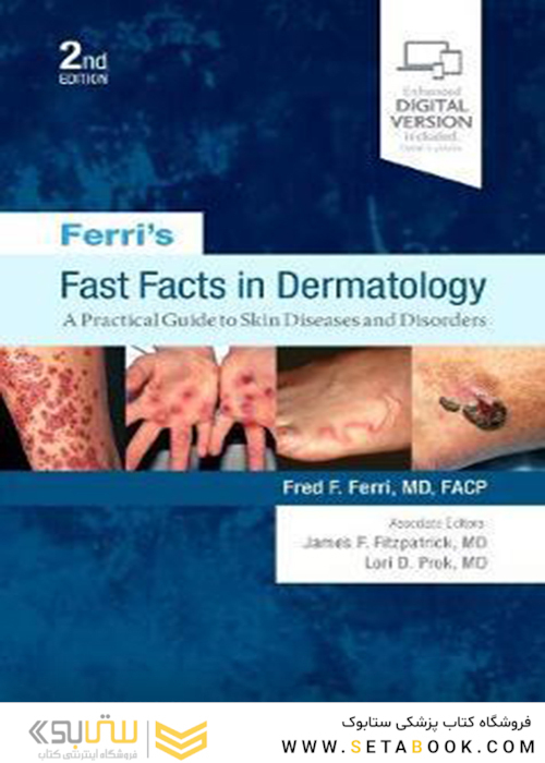Ferri