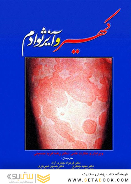 کهیر و آنژیوادم