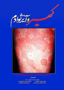 عکس کهیر و آنژیوادم