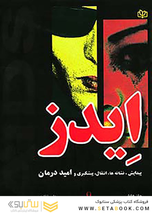 ایدز