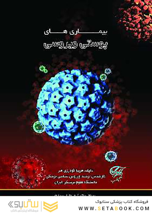 بیماری های پوستی ویروسی