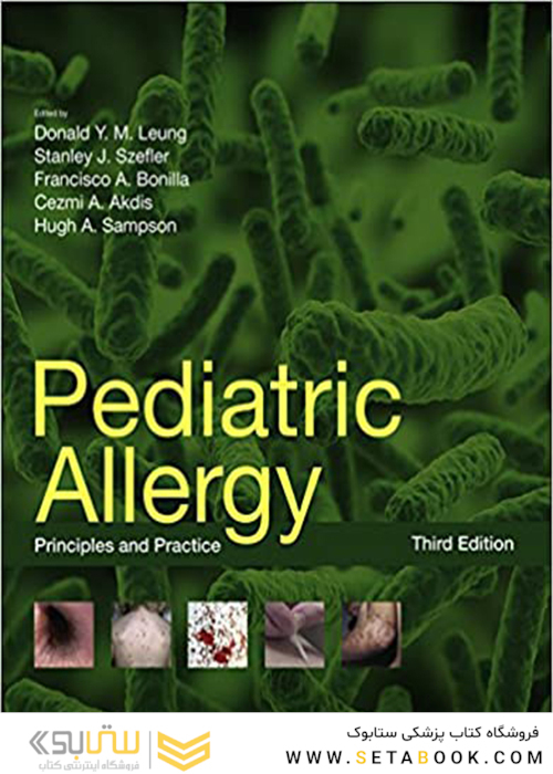 Pediatric Allergy: Principles and Practice 3th Edition2015 آلرژی کودکان: اصول و عمل