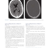 Lange Clinical Neurology and Neuroanatomy: A Localization-Based Approach2017